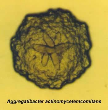 Aggregatibacter