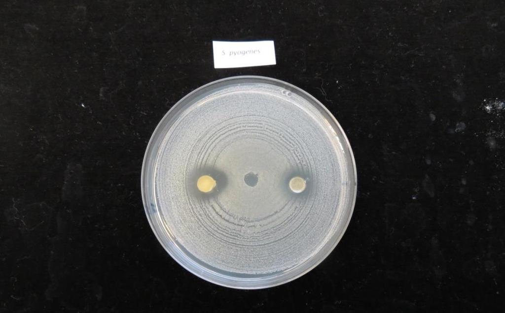 3 Kuva 2. Staphylococcus epidermidis bakteerin kasvun (harmaa, tasainen massa maljalla) estyminen pihka / kasvisöljyseoksen läheisyydessä.