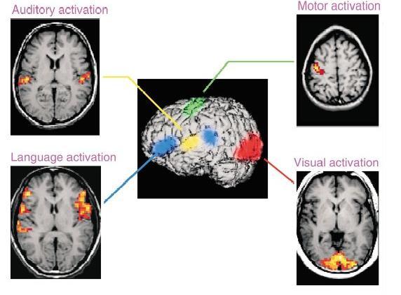 funktionaalinen MRI (fmri)