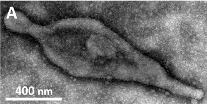 3. Mycoplasma pneumoniae Mycoplasma pneumoniaet ovat keskimäärin kooltaan vain 1-2 µm pitkiä ja 0,1-0,2 µm leveitä. Ne ovat siten tilavuudeltaan alle 5 % tavallisen basillin tilavuudesta. Yleensä M.