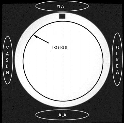 20 Kuva 12. ACR:n mittaus haamuartefakteille. Ympyrät ja soikiot kuvaavat ROI:den sijoittelua.