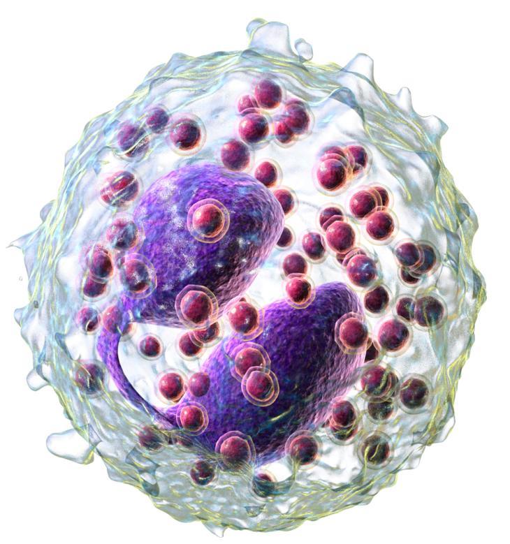 Sisältö Eosinofiilinen pneumonia EGPA