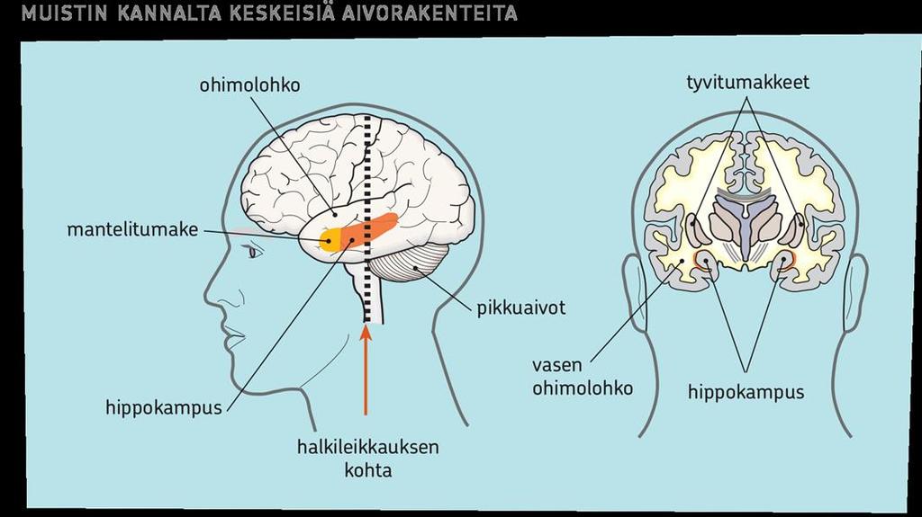 Aivokuorella sijaitsevat asiamuistin tiedot hajautetusti.