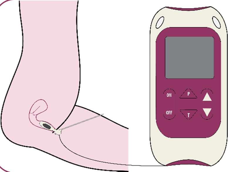 3 4 ON P- Pidä ON-painiketta pohjassa kytkeäksesi
