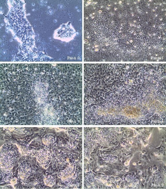 Kuva 11. Trofoblastiprotokollalla viljeltyjä HEL128.5-soluja erilaistumassa kokeessa 6. Käytössä on kymmenkertainen suurennos (10x).
