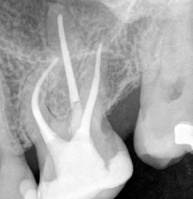 4: Tri Martin Trope