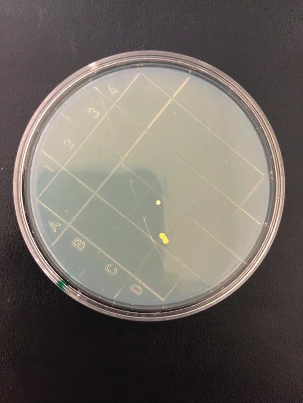 Published online: 01 January 2015 MRSA (Methicillin-resistant Staphylococcus aureus) 1 min 4,71 log10 >99,99% 12 mj/cm² Rutala W et al. 2013.