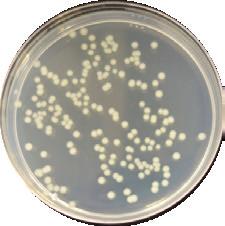 9%) Escherichia Coli 405 nm 65 J/cm 2 > 99,9 % 3,6 log10 (Barneck et al., 2016) Staphylococcus aureus (12.3%) MRSA 470 nm 55 J/cm 2 > 99,999 % > 5 log10 (Bumah et al.
