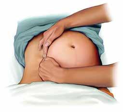 Kuva 1: Kahden käden veto-ote kohdun vetämiseksi sivulle ja aortokavaalisen kompression välttämiseksi raskaana olevaa elvytettäessä (16).