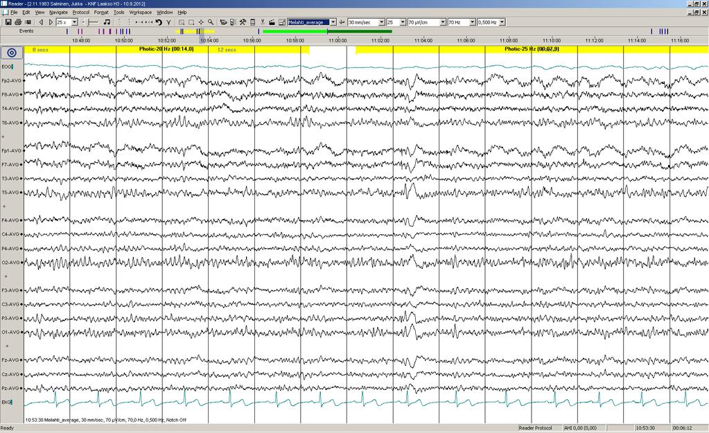 Päiv-EEG-ilmiöitä 12/17:.