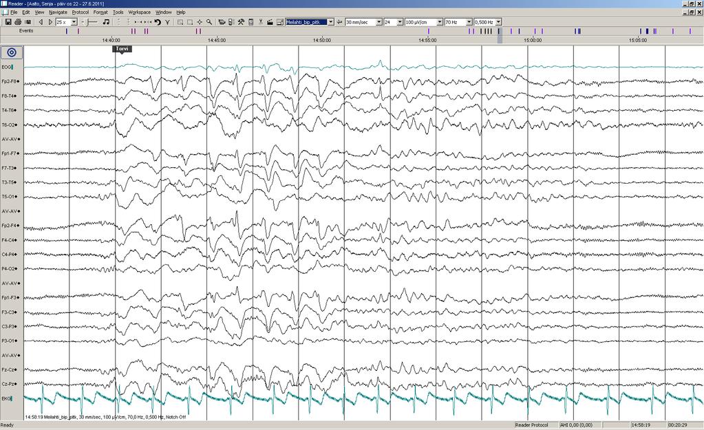 Päiv-EEG-ilmiöitä 15/17: sama