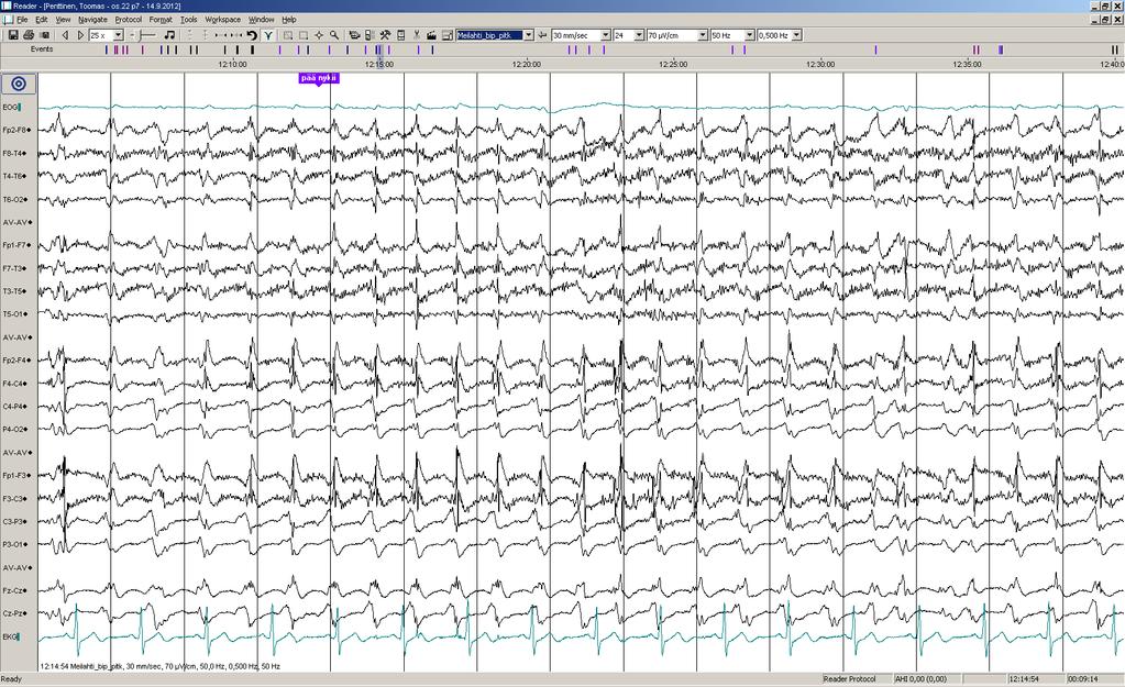 Päiv-EEG-ilmiöitä 16/17: