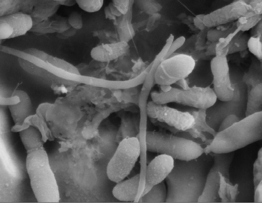 Mitä tarkoitetaan mikrobiologisella korroosiolla?
