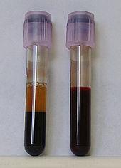 VERI Veren koostumus: Plasma 50% Verisolut ~ 50 %: v Erytrosyytit v Leukosyytit v Trombosyytit