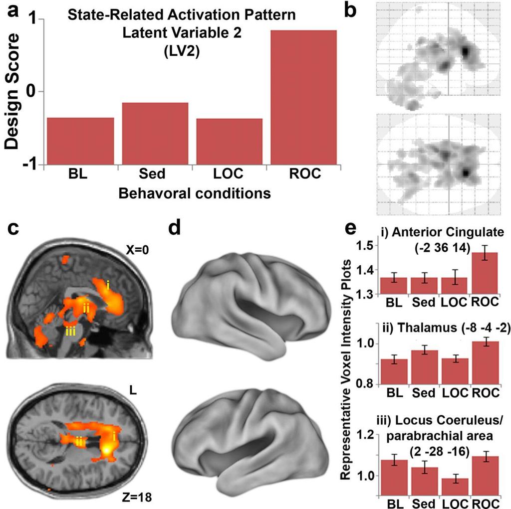 Tietoisuuden palaaminen Anterior cingulate Talamus Locus