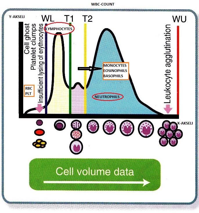 KUVA 8. Sysmex poch-100i TM -analysaattorin tekemä kuvainnollinen WBC-histogrammi, jossa WL alueella on vajavaisesti hajonneet erytrosyytit ja trombosyytit.