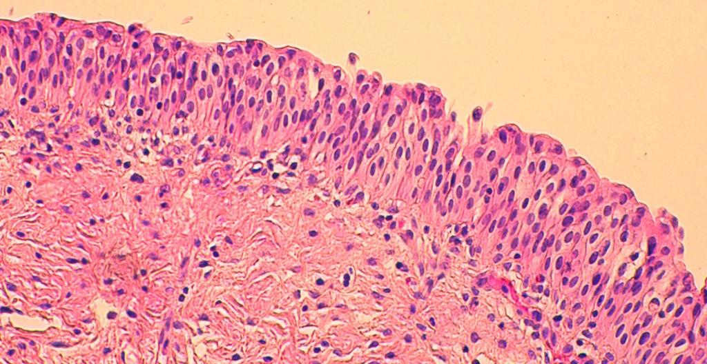 monikulmaisia ja pintasolut suuria, pyöreitä ja ne voivat olla kaksitumaisia. Venyneenä uroteeli näyttäytyy 2-3 solukerroksen paksuisena ja keski- sekä pintakerroksien solut ovat litistyneitä.