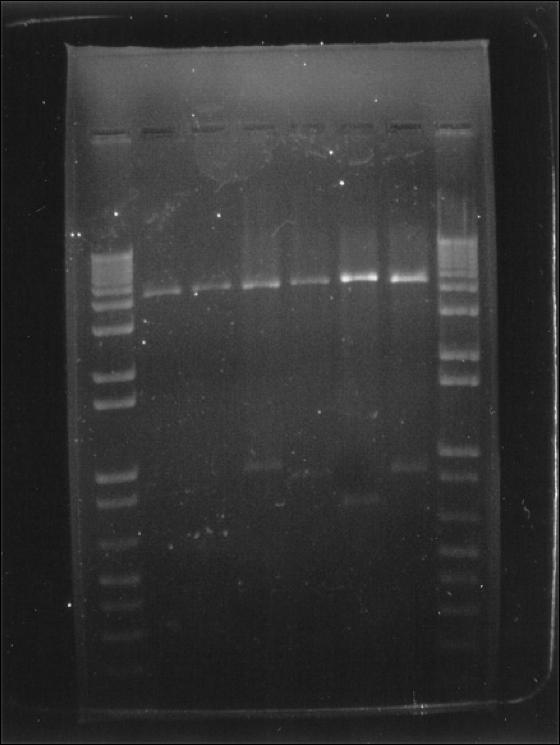 Elektroforeesi Tarkoituksen on erottaa erikokoiset DNApätkät toisistaan, jotka on saatu: 1. Katkaisuentsyymillä 2. PCR:n avulla DNA on negatiivisesti varautunut!