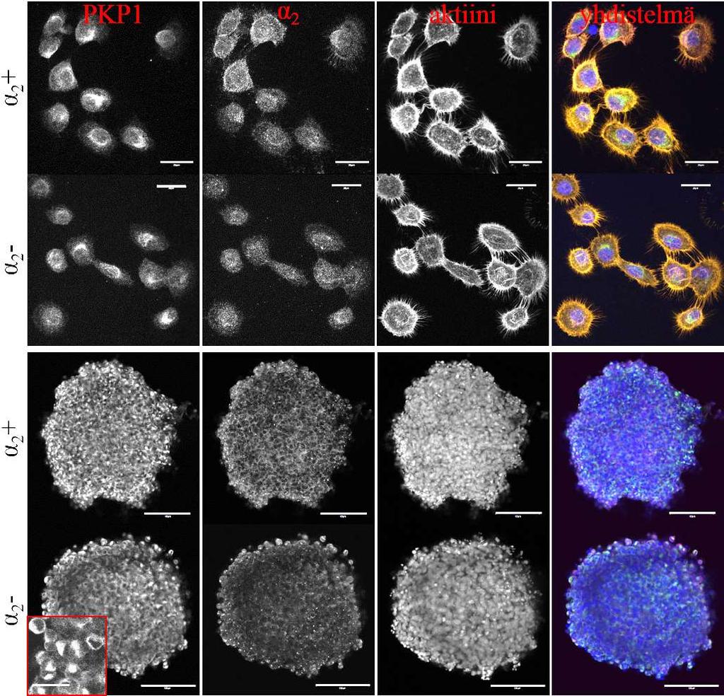 A B Kuva 10. DU145-solutyyppien välillä ei havaittu eroja PKP1-proteiinin lokalisaatiossa.