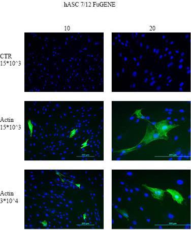 5. Tulokset 5.1 FuGENE transfektiomenetelmän tulokset Kuvissa 9. ja 10. on FuGENE reagenssilla Actin Chromobodyllä transfektoidut hasc 7/12 ja hasc 4/15 linjan solut järjestyksessä.