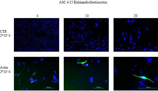 Kuva 23. Kalsiumfosfaattisaostus- menetelmällä transfektoidut hasc 4/15 linjan solut. Transfektioon käytettiin plasmidina Actin Chromobodyä. Näytteitä on 20,000 solua/kuoppa.