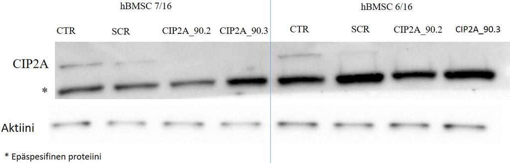 Kuva 35. Chemidoc kuva Western blot analyysistä. Ylempänä kuvassa on CIP2A proteiinin tulokset. Keskimmäinen proteiinijuoste on epäspesifioitu proteiini. Alarivillä on aktiinin pitoisuudet.