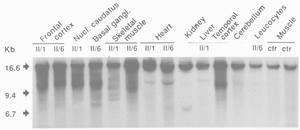 MtDNA:n replikaatio ei toimi