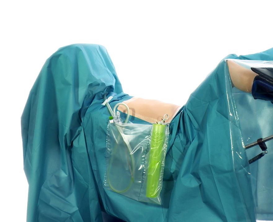 time-saving by using custom procedure trays for