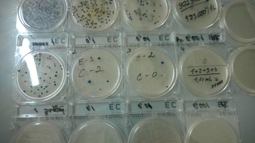 Mikrobiologiset / Bakteerit Tietyt bakteeriryhmät, erityisesti E. coli bakteeri, osoittavat, että ympäristöön on päässyt ulosteperäistä jätettä.
