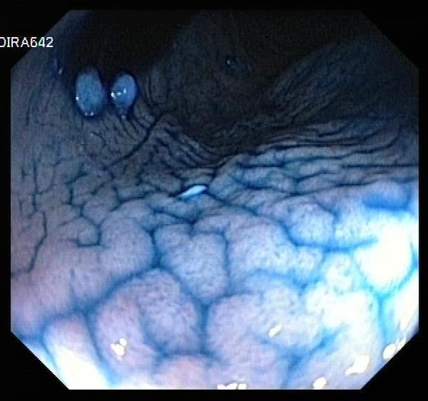 Gastroscopic findings Belgian shepherd dogs Gross, diffuse mucosal irregularity in