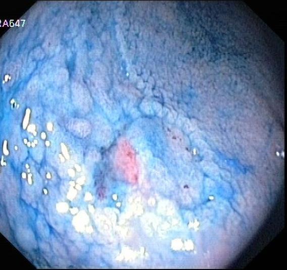 perception of mucosal