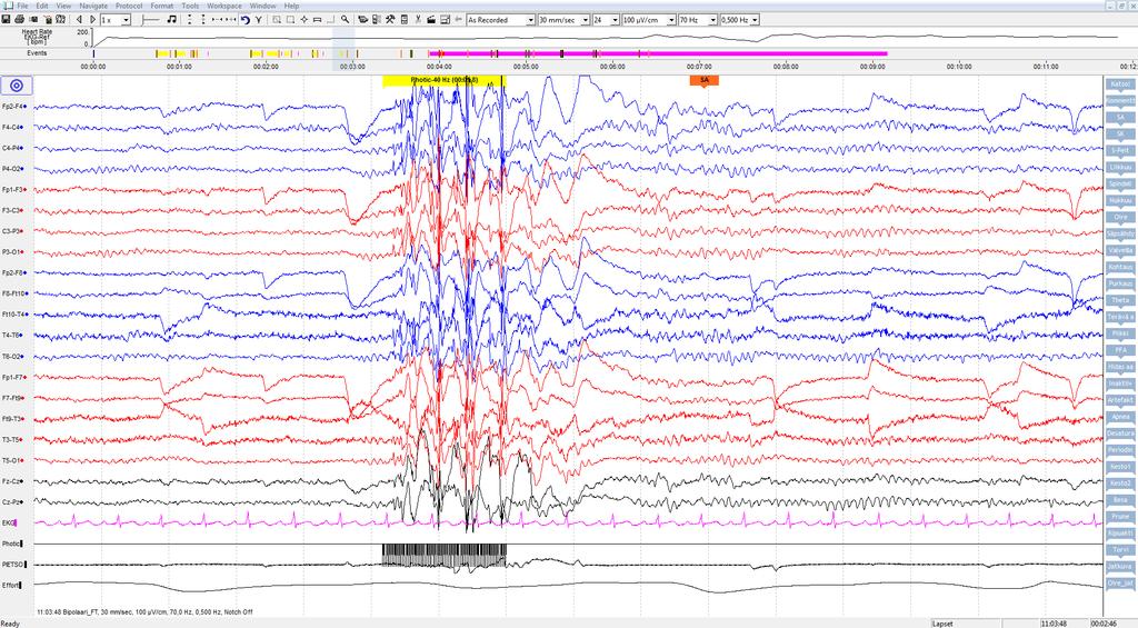 Laskeva vilkku: purkaus 40 Hz vilkkutaajuudella