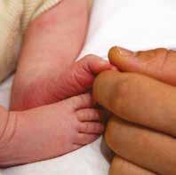 Mitä ihmettä? Eli usein kysytyt kysymykset Napatyngän alkaessa irrota voi kiinnityskohdasta tulla verta. Vauvan iholla on näppylöitä? Useimpien vauvojen iholle nousee ensipäivinä nk.
