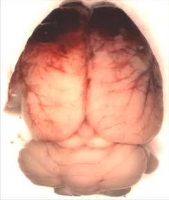 Hyperglycemi Induced Cererl Hemtom Expnsion is Medited y Plsm Kllikrein Authors: Ji Liu, Ben-Bo Go, Allen C. Clermont, Price Blir, Tmie J.