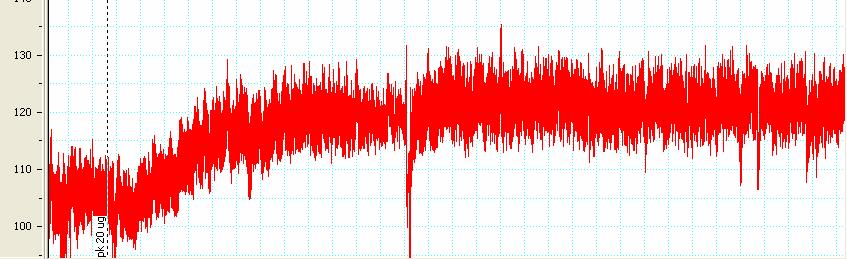 Representtive imges of the lood pressure recording from () NDM nd () DM rts following cererl infusion of PK.