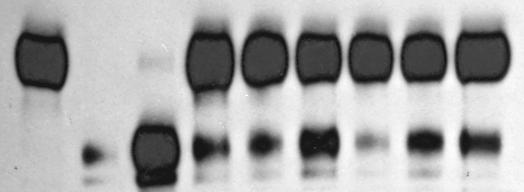 Supplementry Figure 7 Plsminogen + - + + + + + + + Plsmin - + - - - - - - - tpa (nm) - - 5 - - - - - - PK (nm) - - - 16 32 64 16 32 64 Glucose (mm) - - - - - - 25 25 25 Protein level (fold) 2.5 2. 1.5 1.