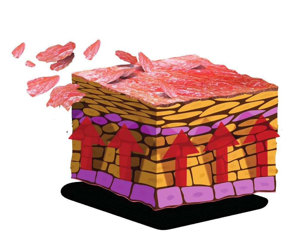 Psoriaasi Psoriaasi on ihon ja nivelten monimuotoinen, krooninen immunologinen tulehdustauti, johon liittyy perinnöllisyyttä.