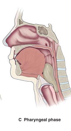 Kolmas vaihe Alkaa sekunnin kesta va kolmas vaihe eli faryngeaalinen vaihe, jossa tapahtuu la hes yhta aikaisia nieluntoimintoja.