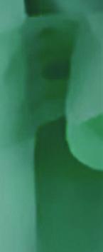 3. Neugut AL, Ghatak AT, Miller RL. 2001.