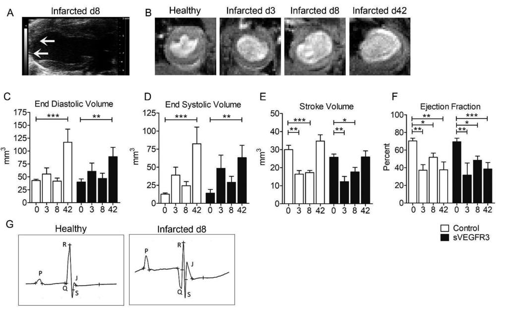 47 To evaluate the effects of deficient lymphatic function on cardiac parameters, we performed functional ultrasound imaging, MRI imaging and echocardiography on healthy hearts and 3, 8 and 42 days