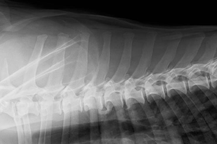 spondyloosi