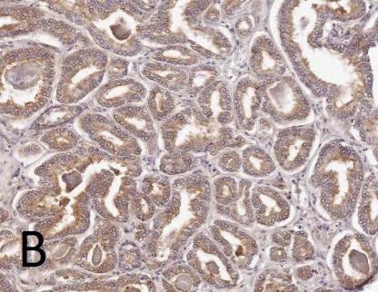 UNC13B expression in prostate tissue specimens.