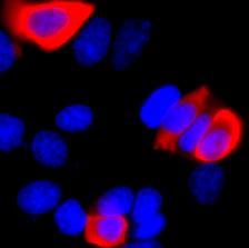 Representative fluorescence microscope