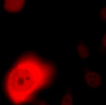 PC-3, and LNCaP cells.