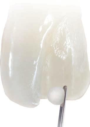 2019 Dentsply Sirona. All rights reserved. Ceram.x Spectra ST Ce r so a m.