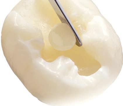 toiminalliset tarpeet 5 % Natriumfluoridi Ceram.