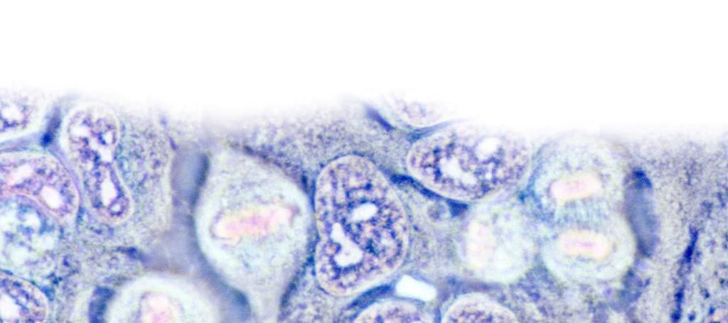 HeLa-solut Virginialainen Henrietta Lacks kuoli kohdunkaulan syöpään 31-vuotiaana vuonna 1951 haudattiin nimettömänä