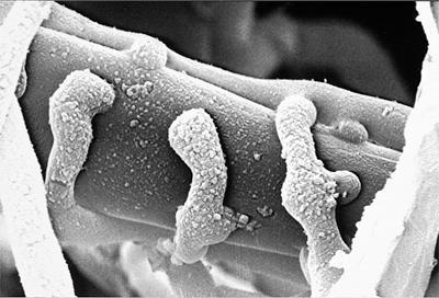 Mihin mikrobiologinen kasvitautien torjunta perustuu?