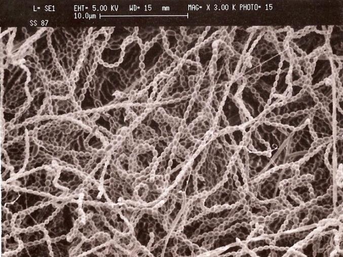 Mycostop biofungisidi Sisältää suomalaisesta rahkaturpeesta eristettyä Streptomyces K61