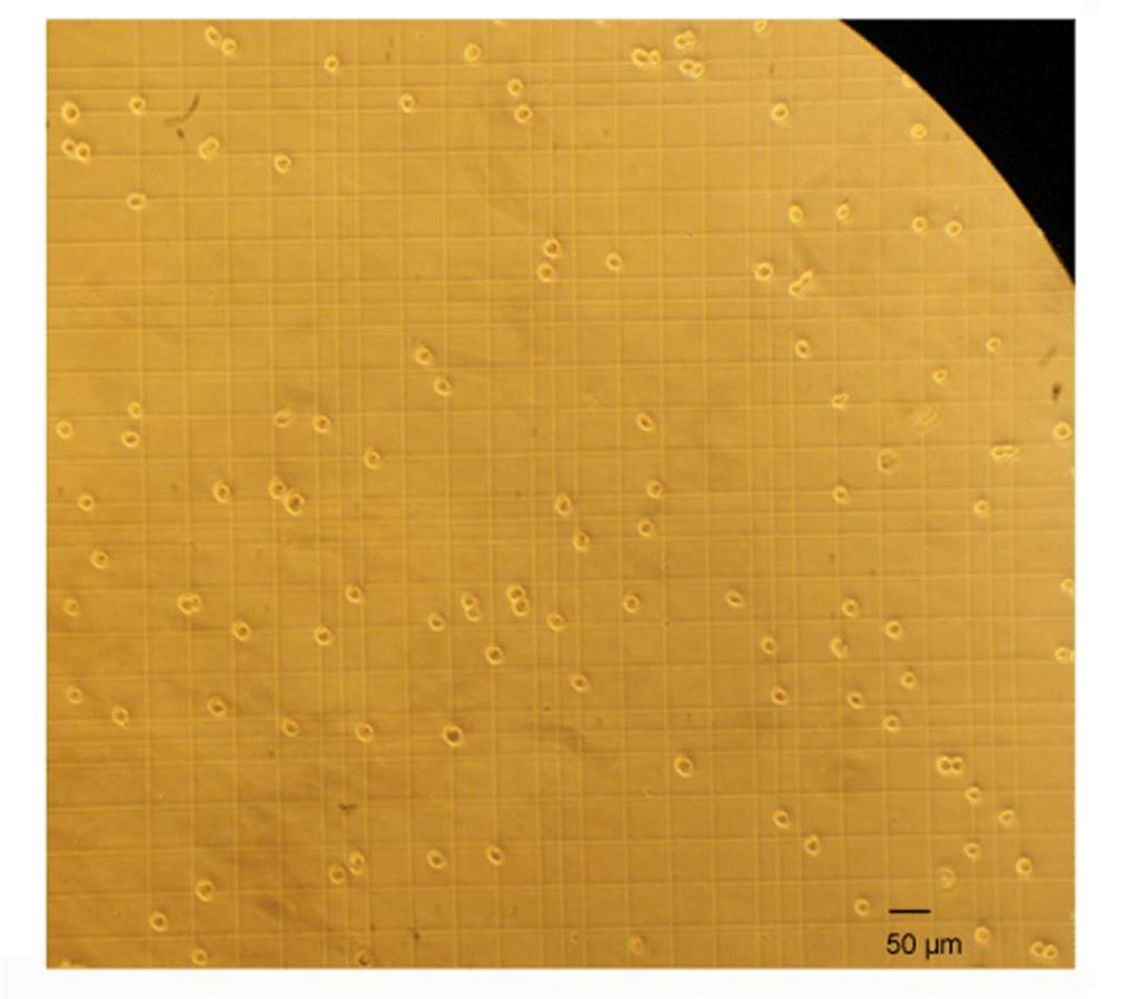 27 Pictures of uninfected cells compared to the infected ones through a 10X objective.